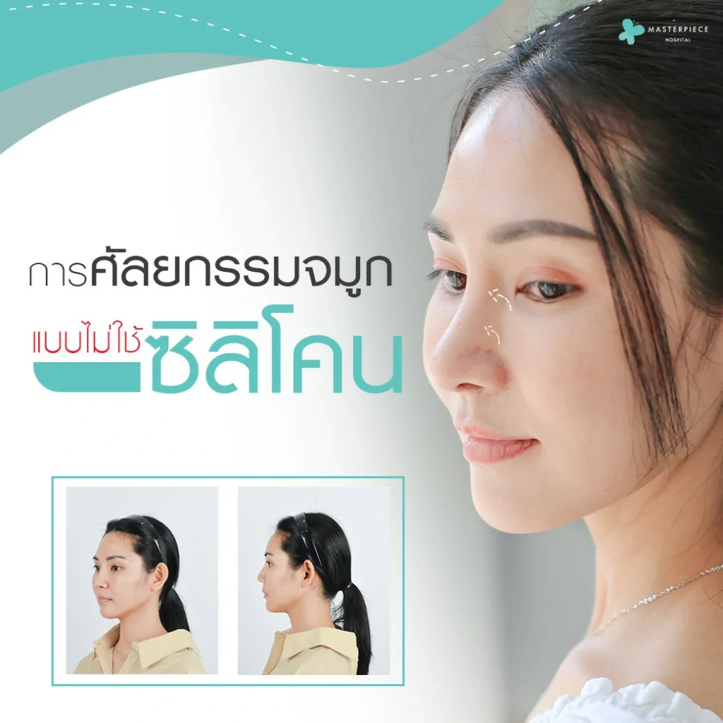 การศัลยกรรมจมูกแบบไม่ใช้ซิลิโคน-No-Silicone-คืออะไร.