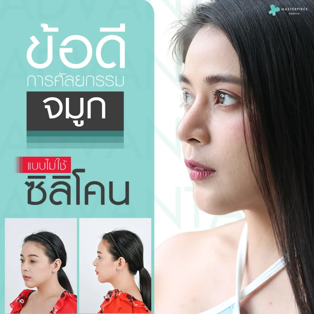 ข้อดีของการศัลยกรรมจมูกแบบไม่ใช้ซิลิโคน (No Silicone)